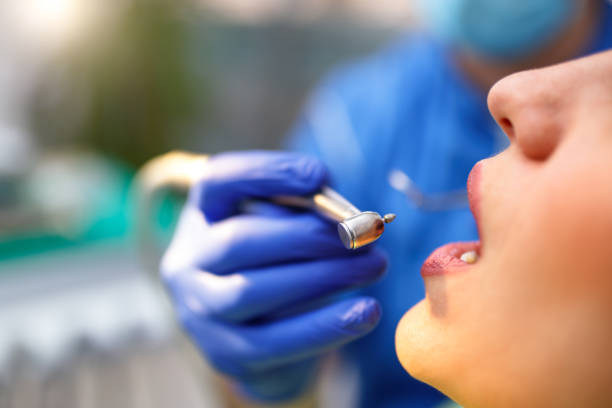 Dental Bonding in East Grand Rapids, MI